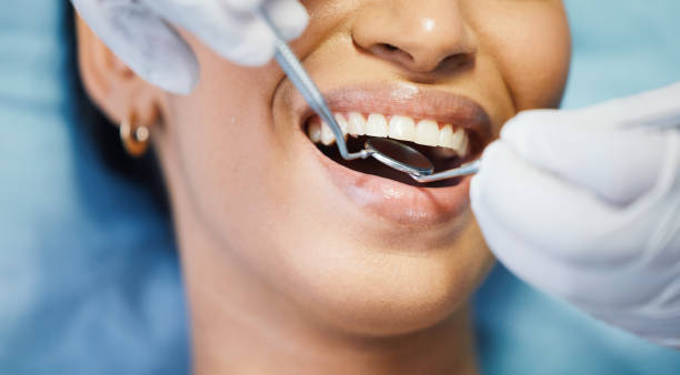 Best Emergency Dental Extractions in Hendron, KY